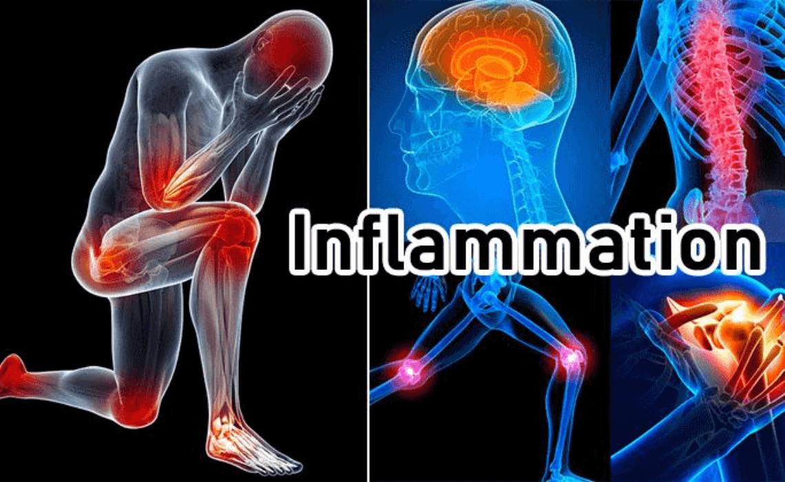 INFLAMMATION