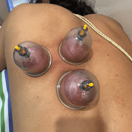 Vestibular Therapy