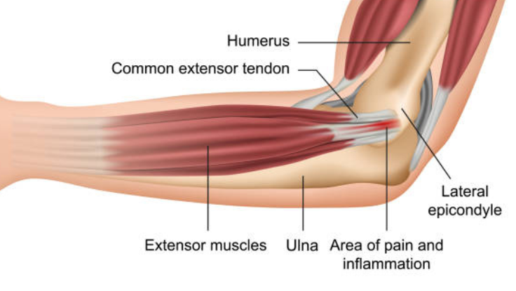 ELBOW